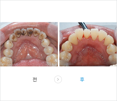 스케일링 이미지