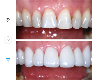 이맥스 전후 이미지
