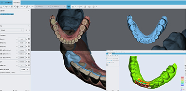 얼굴 3D CT 이미지